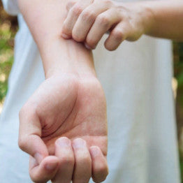 Person scratching insect bite